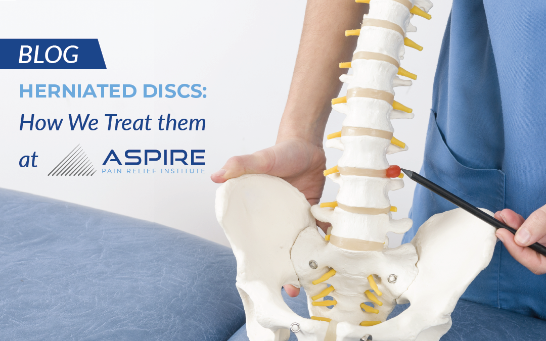 Herniated Discs: How We Treat them at Aspire